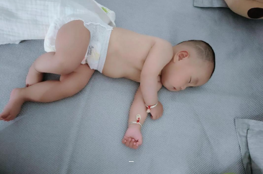 深圳合法供卵试管中心宝宝脸上有白色斑块